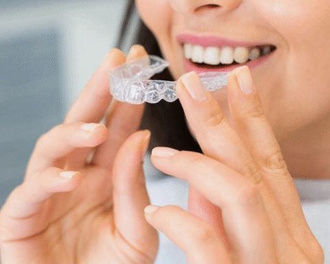 Understanding the Dental Clear Aligner Process for a Perfect Smile