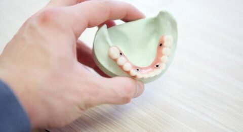 Journey to a Perfect Smile